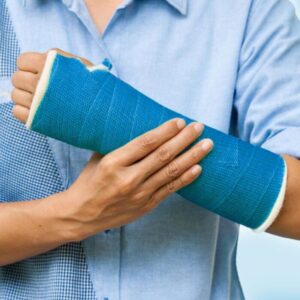 NovaCast Fiber Glass Cast Tape – Blue
